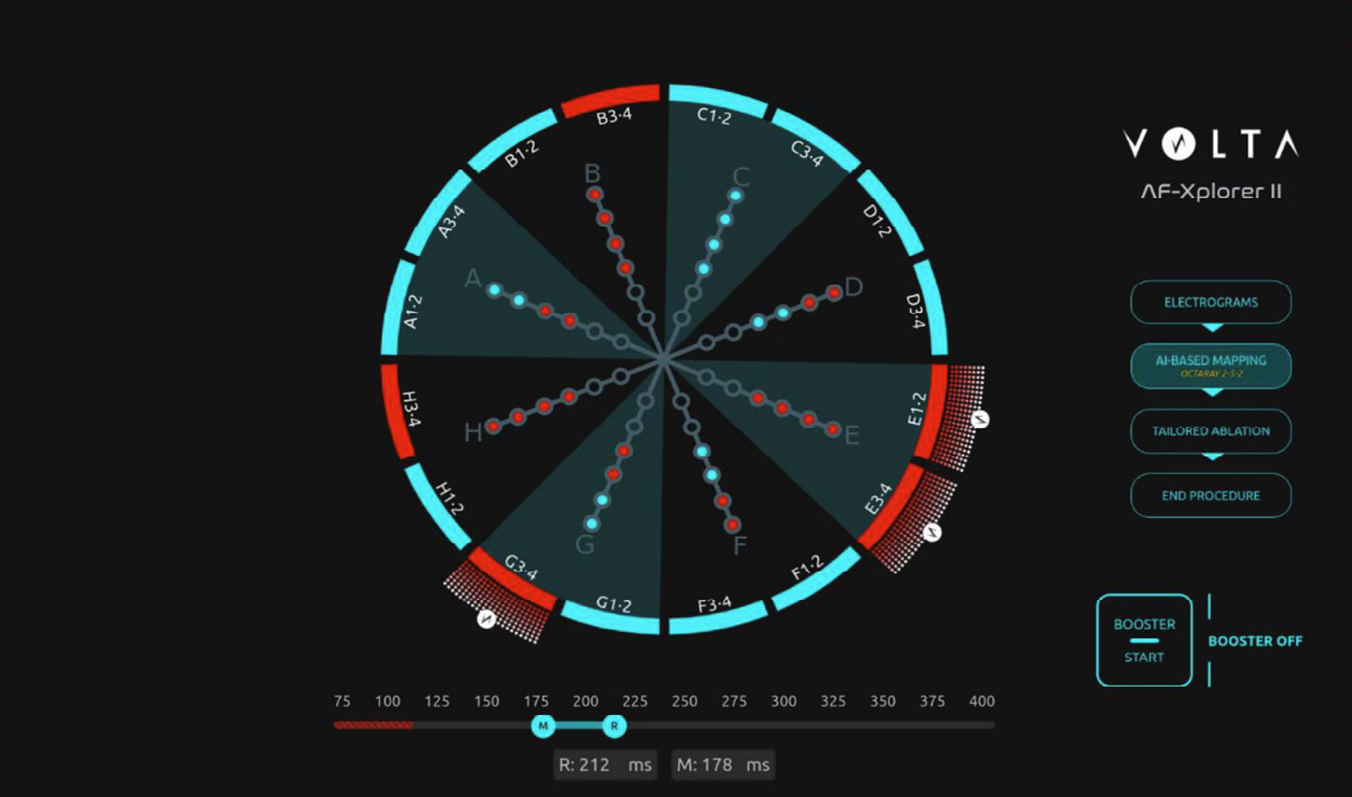 AF-Xplorer II-thumbnail